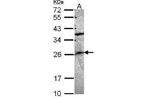 WB Image Sample (30 ug of whole cell lysate) A: A549 12% SDS PAGE antibody diluted at 1:1000 (GRAP antibody  (C-Term))