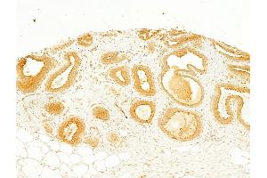 ABIN6260660 and ABIN6268685 at 1/100 staining Human normal tissues adjacent to breast cancer by IHC-P. (CD9 antibody  (Internal Region))