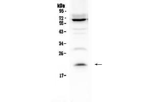 Western blot analysis of IL13 using anti-IL13 antibody . (IL-13 antibody  (AA 36-146))