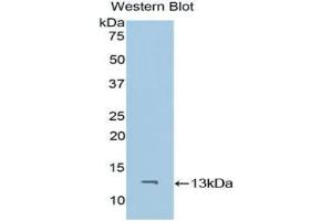 Western blot analysis of the recombinant protein. (CD59 antibody  (AA 26-98))