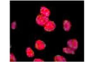 Anti-ATM Monoclonal Antibody - Immunofluorescence Microscopy Anti ATM antibody showing overlay of anti-ATM pS1981 staining.