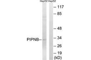 Western Blotting (WB) image for anti-Phosphotidylinositol Transfer Protein, beta (PITPNB) (AA 20-69) antibody (ABIN2890500) (PITPNB antibody  (AA 20-69))