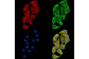 ABIN7096320 and ABIN7100382 staining Hela cells by IF/ICC. (Calpain 8 antibody)