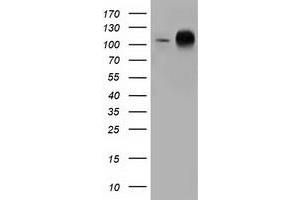 Western Blotting (WB) image for anti-Transforming, Acidic Coiled-Coil Containing Protein 3 (TACC3) antibody (ABIN1498100) (TACC3 antibody)