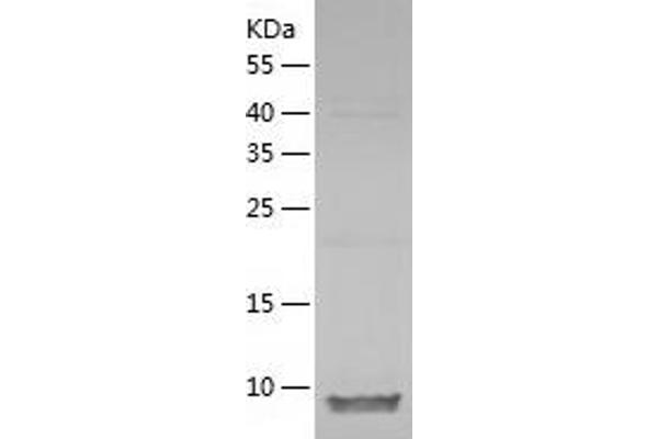 PDE6H Protein (AA 1-83) (His tag)