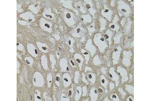 Immunohistochemistry of paraffin-embedded Human esophagus using IL33 Polyclonal Antibody (IL-33 antibody)