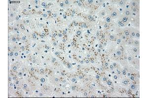 Immunohistochemical staining of paraffin-embedded Ovary tissue using anti-CHEK2mouse monoclonal antibody. (CHEK2 antibody)