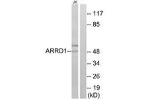 Western blot analysis of extracts from Jurkat cells, using ARRD1 Antibody. (ARRD1 antibody  (AA 167-216))