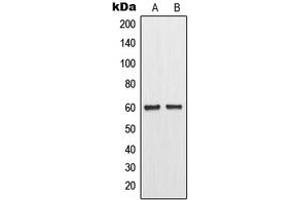 Western blot analysis of MMP11 expression in MCF7 (A), Raw264. (MMP11 antibody  (Center))