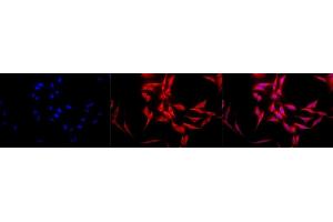 Immunocytochemistry (ICC) image for anti-Heat Shock Protein 70 (HSP70) antibody (ABIN361821)
