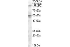 Image no. 1 for anti-Endoplasmic Reticulum Aminopeptidase 2 (ERAP2) (Internal Region) antibody (ABIN374998) (ERAP2 antibody  (Internal Region))