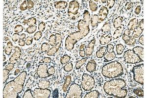 IHC analysis of PPFIA1 using anti-PPFIA1 antibody (ABIN7600454). (PPFIA1 antibody  (AA 198-1202))