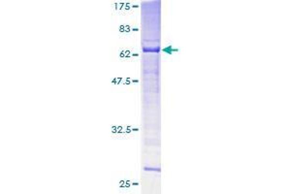 SPO11 Protein (AA 1-358) (GST tag)