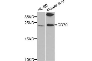 Western blot analysis of extracts of various cell lines, using CD70 antibody (ABIN5971064) at 1/1000 dilution. (CD70 antibody)