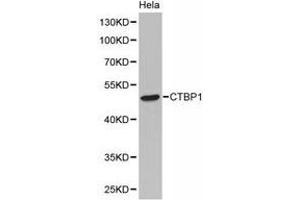 Western Blotting (WB) image for anti-C-terminal Binding Protein 1 (CTBP1) antibody (ABIN1872058) (CTBP1 antibody)
