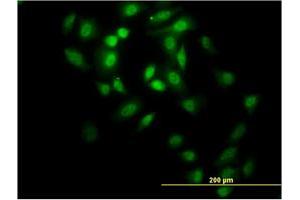 Immunofluorescence of monoclonal antibody to GABPA on HeLa cell. (GABPA antibody  (AA 1-100))