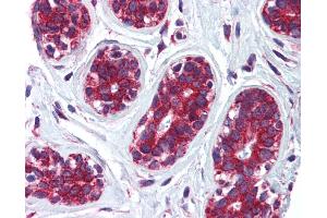 Immunohistochemistry (IHC) image for anti-Cytoskeleton-Associated Protein 4 (CKAP4) (Middle Region) antibody (ABIN2782739) (CKAP4 antibody  (Middle Region))
