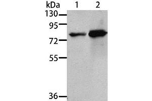Western Blot analysis of 293T and A431 cell using MSN Polyclonal Antibody at dilution of 1:500 (Moesin antibody)