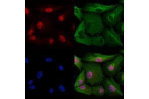 ABIN6265557 and ABIN6278407 staining  cells by IF/ICC. (THOC1 antibody  (C-Term))