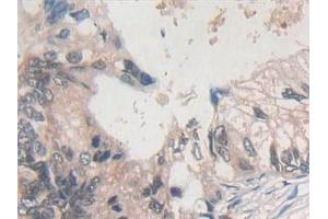 Immunohistochemistry (IHC) image for anti-Phospholamban (PLN) (AA 1-52) antibody (ABIN7442687)