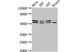Western Blot Positive WB detected in: Hela whole cell lysate, 293 whole cell lysate, U87 whole cell lysate, Rat brain tissue All lanes: CD3EAP antibody at 3. (CD3EAP antibody  (AA 289-404))
