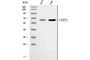 Western blot analysis of Cytokeratin 1/KRT1 using anti-Cytokeratin 1/KRT1 antibody (ABIN7600651).