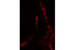 ABIN6274182 staining K562 by IF/ICC. (HOXB9 antibody  (N-Term))