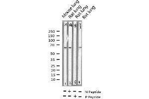 Western Blotting (WB) image for anti-Protein-tyrosine Phosphatase 1C (PTPN6) (pTyr536) antibody (ABIN6255949)