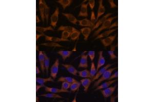 Immunofluorescence (IF) image for anti-Insulin-Like Growth Factor 2 mRNA Binding Protein 3 (IGF2BP3) (AA 300-579) antibody (ABIN6142245)