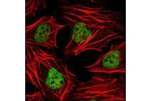 Confocal immunofluorescence analysis of Hela cells using HDAC3 mouse mAb (green). (HDAC3 antibody  (AA 224-428))