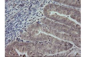 Image no. 2 for anti-Mitogen-Activated Protein Kinase Kinase 3 (MAP2K3) antibody (ABIN1499403) (MAP2K3 antibody)