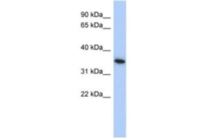 Western Blotting (WB) image for anti-MAX Interactor 1 (MXI1) antibody (ABIN2463882) (MXI1 antibody)