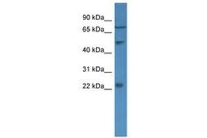 Image no. 1 for anti-Guanylate Cyclase Activator 1B (Retina) (GUCA1B) (AA 34-83) antibody (ABIN6746667) (GUCA1B antibody  (AA 34-83))