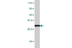 Western Blotting (WB) image for anti-Hepatocyte Growth Factor-Regulated tyrosine Kinase Substrate (HGS) (AA 513-612) antibody (ABIN563958)