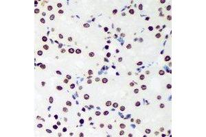 Immunohistochemical analysis of Sox-5 staining in rat kidney formalin fixed paraffin embedded tissue section. (SOX5 antibody)
