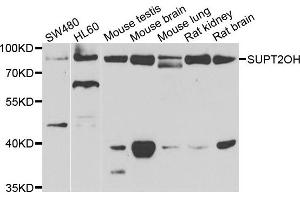 Western blot analysis of extracts of various cell lines, using SUPT20H antibody. (FAM48A/P38IP antibody)