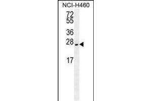 EIF4E2/M antibody (ABIN659116 and ABIN2843758) western blot analysis in NCI- cell line lysates (35 μg/lane). (EIF4E2 antibody)
