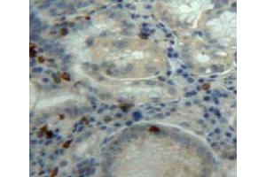 Used in DAB staining on fromalin fixed paraffin-embedded stomach tissue (DDOST antibody  (AA 43-427))