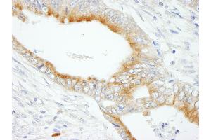 anti-Microtubule-Associated Protein 7 (MAP7) (AA 690-720) antibody