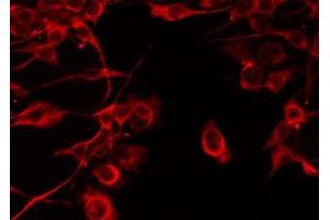 ABIN6277527 staining Hela by IF/ICC. (C1QB antibody  (Internal Region))