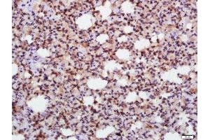 Immunohistochemistry (Paraffin-embedded Sections) (IHC (p)) image for anti-Transcription Factor 3 (E2A Immunoglobulin Enhancer Binding Factors E12/E47) (TCF3) (AA 75-180) antibody (ABIN701605)