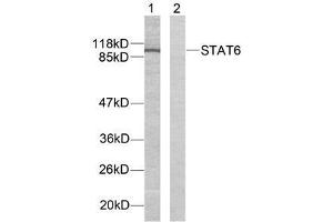 Western blot analysis of extracts from HeLa cells using STAT6 (Ab-641) antibody (E021050). (STAT6 antibody)