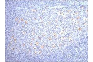 IHC staining of human tonsil tissue, diluted at 1:200. (CD68 antibody)