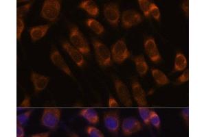 Immunofluorescence analysis of L929 cells using SEC61B Polyclonal Antibody at dilution of 1:100. (SEC61B antibody)