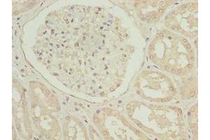 Immunohistochemistry of paraffin-embedded human kidney tissue using ABIN7173675 at dilution of 1:100