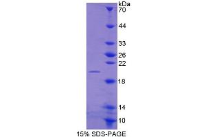 SDS-PAGE of Protein Standard from the Kit (Highly purified E. (MMP13 CLIA Kit)