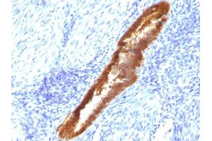 Formalin-fixed, paraffin-embedded human Endometrium stained with ASRGL1 Mouse Monoclonal Antibody (CRASH/1289). (ASRGL1 antibody)
