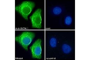 ABIN190899 Immunofluorescence analysis of paraformaldehyde fixed A549 cells, permeabilized with 0. (SLC7A11 antibody  (Internal Region))