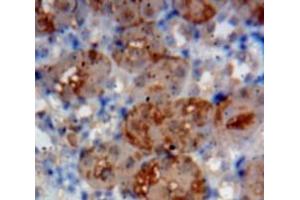 Used in DAB staining on fromalin fixed paraffin-embedded Kidney tissue (IL1RL1 antibody  (AA 357-532))