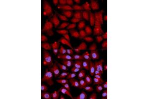 Immunofluorescence analysis of U2OS cell using MAP2K6 antibody. (MAP2K6 antibody  (AA 1-334))